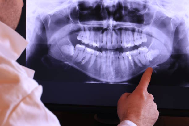 Best Root Canal Emergency Dentist  in Albany, MN