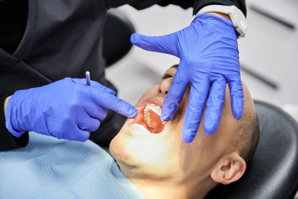 Best Dentist for Tooth Abscess  in Albany, MN