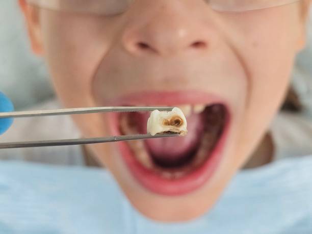 Best Teeth Whitening  in Albany, MN